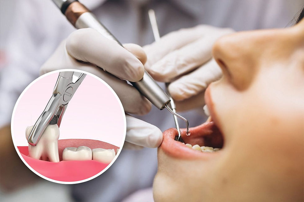 Why Tooth Removal Might Be Necessary — And When to Avoid It