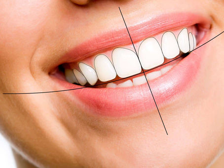5 Reasons Why Digital Smile Design Is the Best Solution for Smile Makeovers