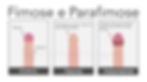 Ilustração comparando pênis em três situações: normal, fimose e parafimose. Na imagem “Normal”, a glande está totalmente exposta e o prepúcio recobre apenas a base. Na “Fimose”, há dificuldade de retrair o prepúcio que cobre a glande. Na “Parafimose”, o prepúcio fica preso atrás da glande e não retorna à posição normal. Material educativo do Dr. Daniel Sucupira, urologista em Fortaleza.