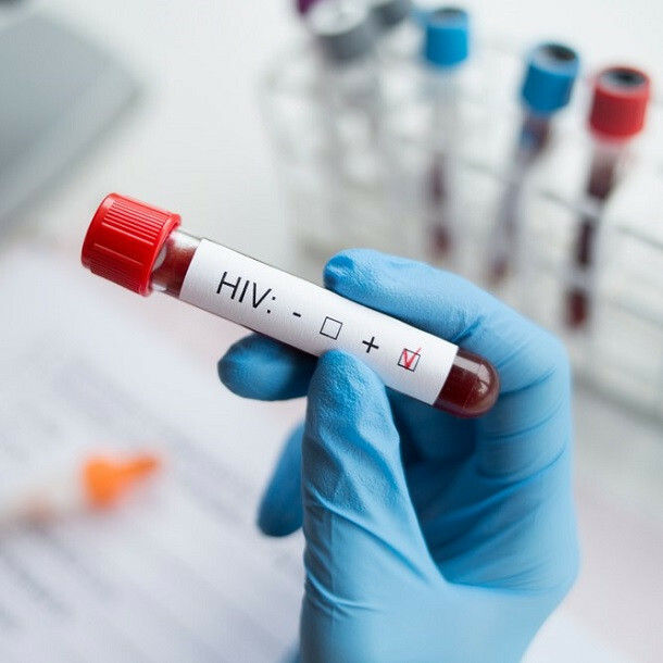 inline__hiv-test-positive-itm-clinics.jpg