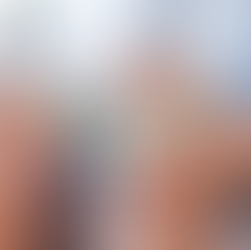 膝裏の張り・痛み / Tightness behind the knee