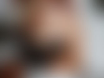 Flawless Confidence: Real Stories of Women Thriving After Hair Loss