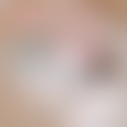 Missing your period for three months? It’s not always PCOS—it could be Hypothalamic Amenorrhea (HA).