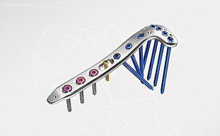 Tratamiento de Fracturas de Tibia Proximal