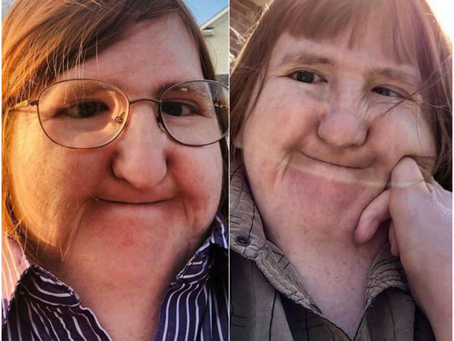 Traitée de « laide » sur Internet, Melissa transforme les moqueries en message de confiance