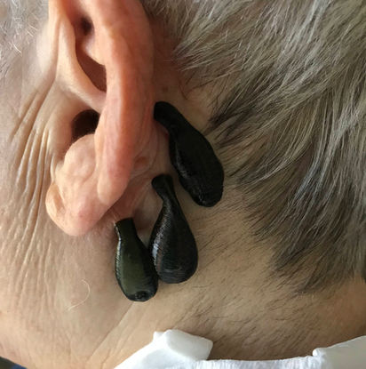 masaż sportowy 47-220/masaże na bóle mięśni