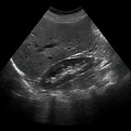 How much does an ultrasound cost
