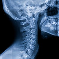 How much does an x-ray cost
