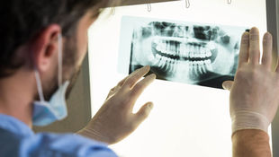 Streamlining Dental Eligibility with HiPaaS AI