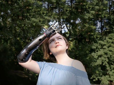 NEW CLASS: Prosthetics