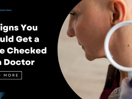 mole removal Singapore