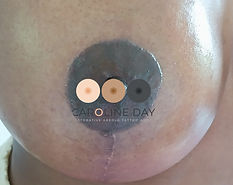 B Areola.jpg