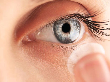 Safilens : une étude confirme l'efficacité de lentilles de contact dans le ralentissement de la myopie