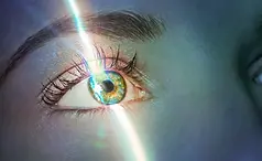 laser eye surgery