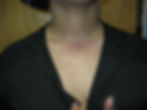 Neck Dermal