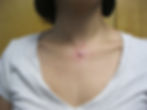 Neck Dermal