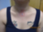 Neck Dermal