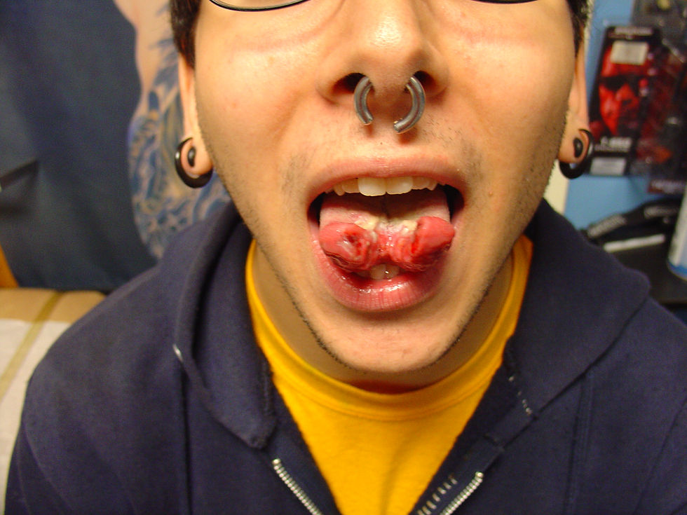 Tongue Splitting