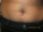 Navel Captive