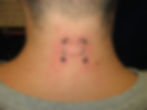 Double Nape 2
