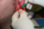 Ear Scalpling