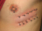 Rib Surface