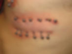 Rib Surface