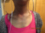 Neck Dermal