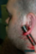 Ear Scalpling
