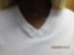 Neck Dermal