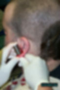Ear Scalpling