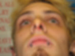Septum Punch