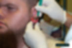 Ear Scalpling