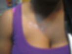 Neck Dermal