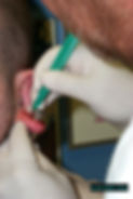 Ear Scalpling