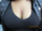 Chest Dermal