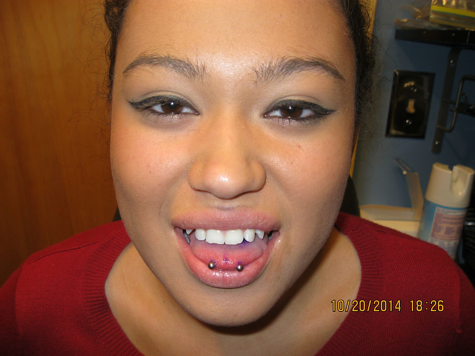 Tip of Tongue