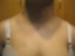 Neck Dermal