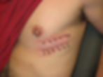 Rib Surface