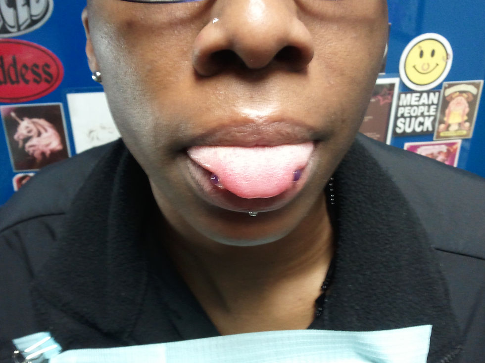 Horizontal Tongue