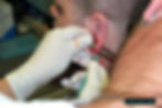 Ear Scalpling