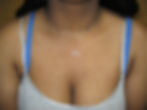 Neck Dermal