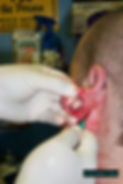 Ear Scalpling