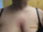 Chest Micro