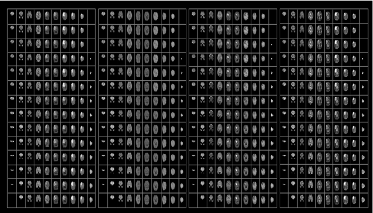 Brain Image.PNG