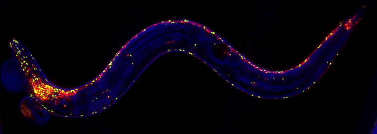 morimotolab-singlec.elegans-polyq.tif