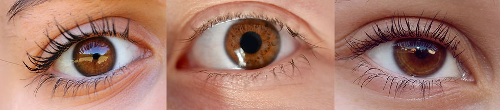 Three images placed side by side show brown eyes of a girl.