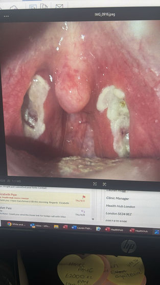 Understanding Bad Bacteria: Causes and Solutions for Bad Breath