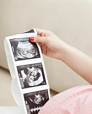 Ultrasound
