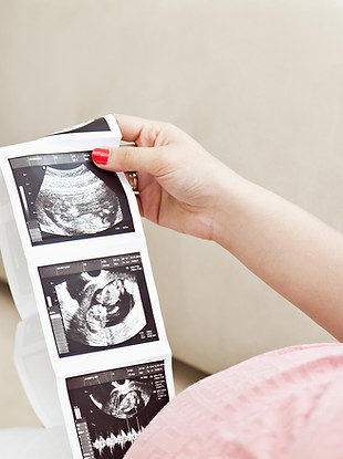Grossesse Naturoptahie neuronutrition echographie